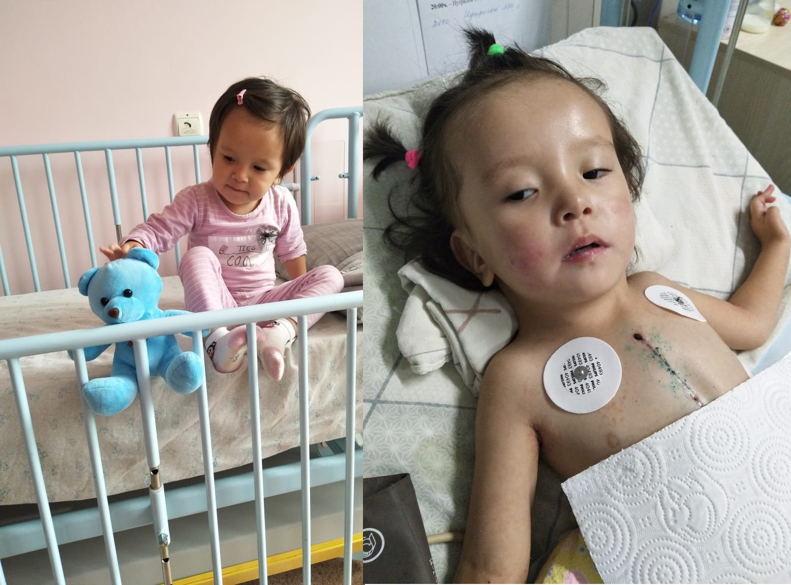 Алматыда жүрегіне операция жасатқан баланың халі ауыр