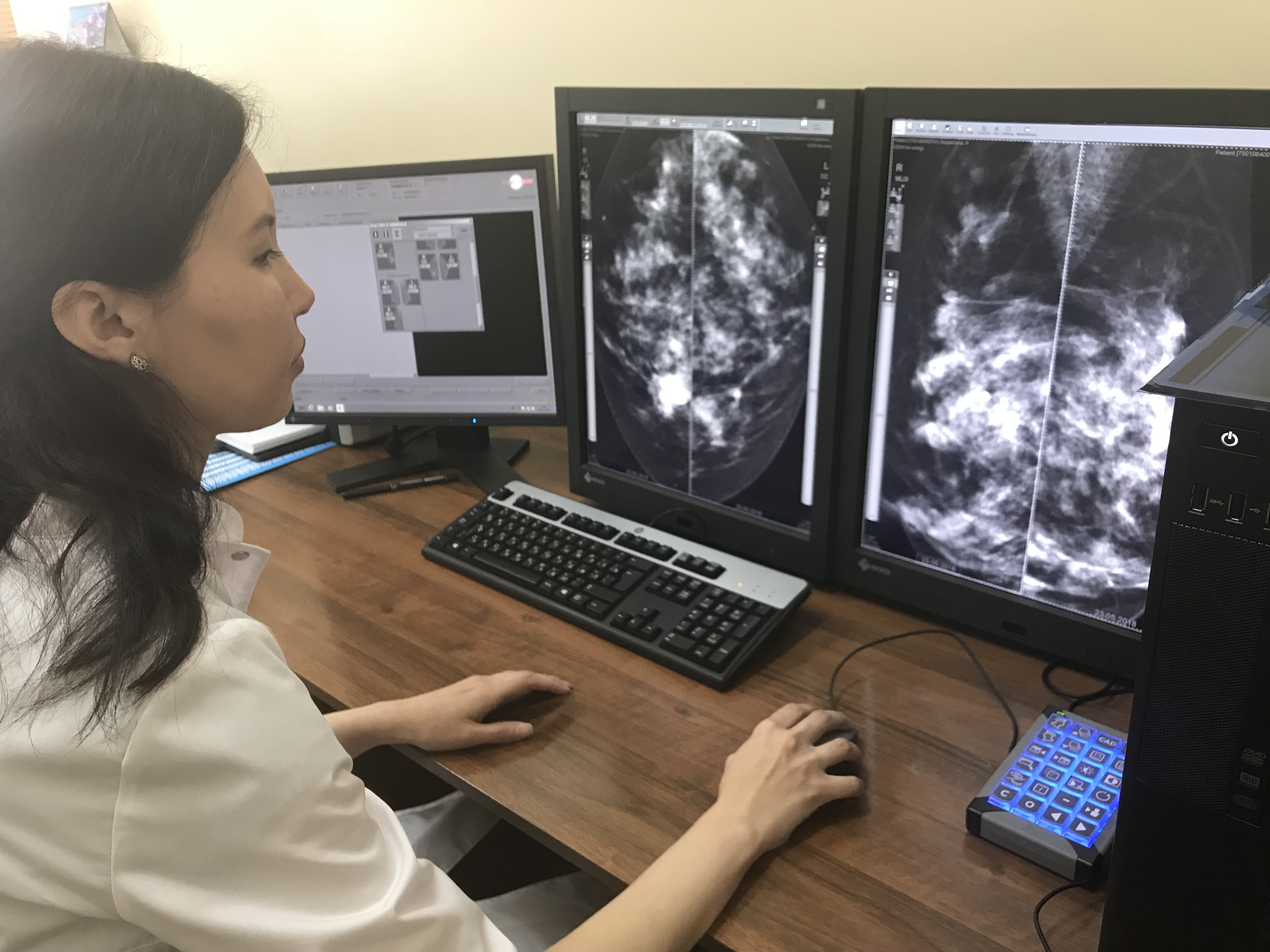 Үкіметтің онкологиялық аурулардың алдын алу жөніндегі Кешенді жоспары жүзеге асып отыр ма?