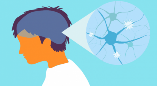 Бүгін – Дүниежүзілік  шашыраңқы склерозбен күрес күні