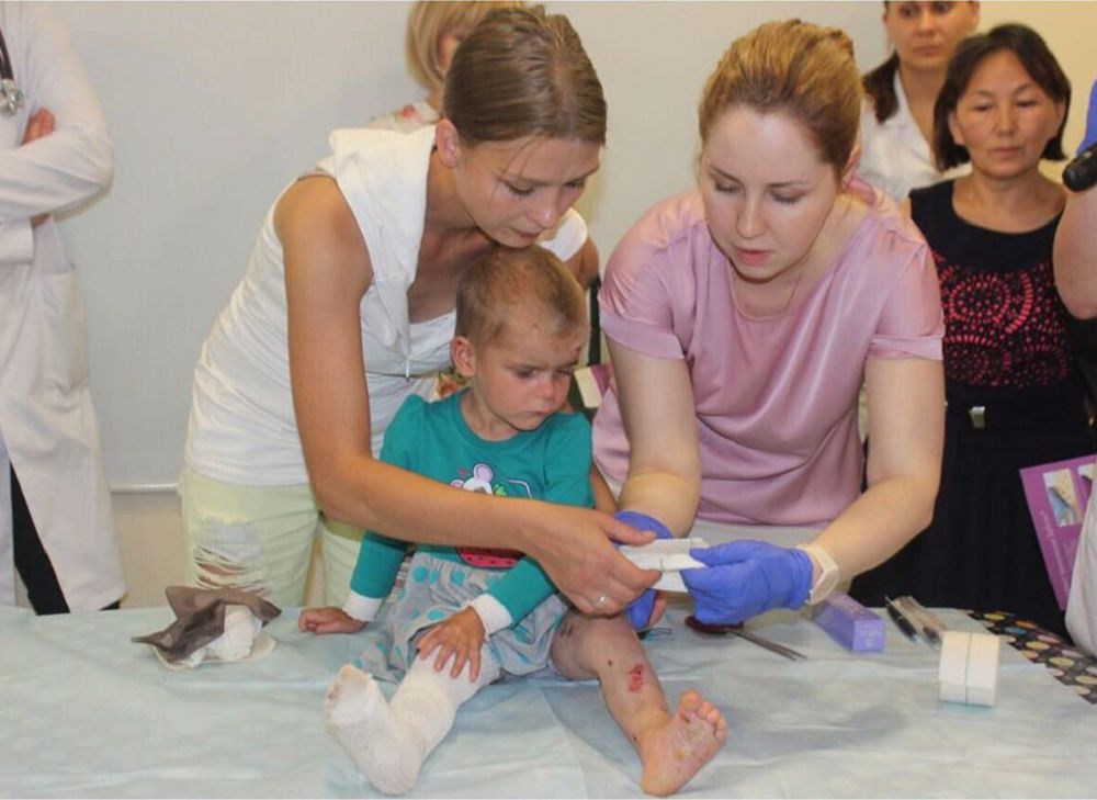 «Көбелек ауруы» дейтін кесел бар