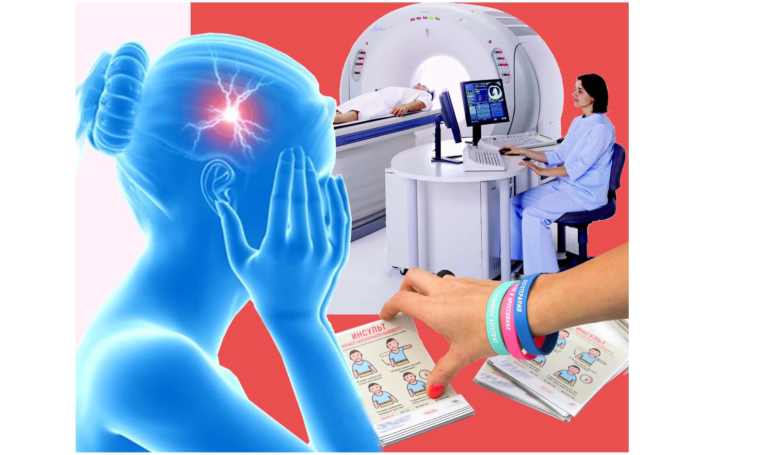 Инсультке иілмеудің  жолдарын қарастырады