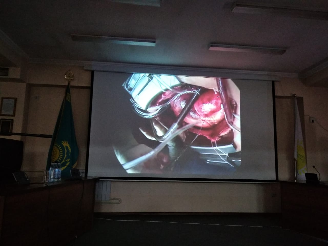 Отандық дәрігерлеріміз алғаш рет неміс кардиологтарымен бірге отаның жаңа түрін жасады