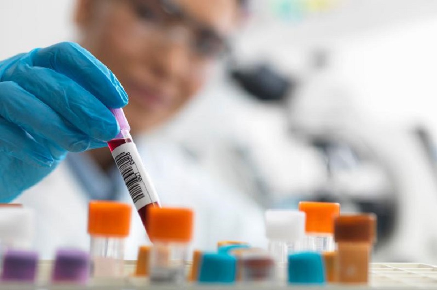 100 жылда бір рет Жерге үлкен ауру келеді. Сәйкестік пе?