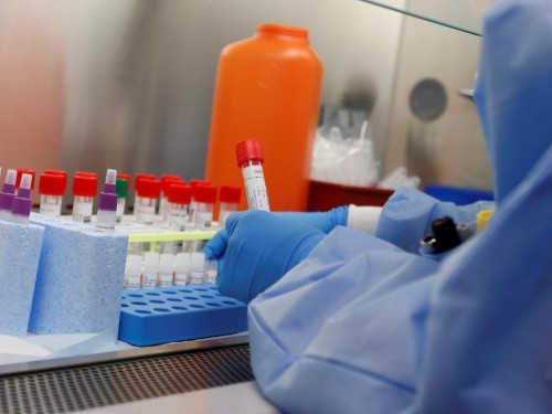 Түркістан облысы: Коронавирус жұқтырған адаммен бірге келген 10 жолаушы іздестіріліп жатыр