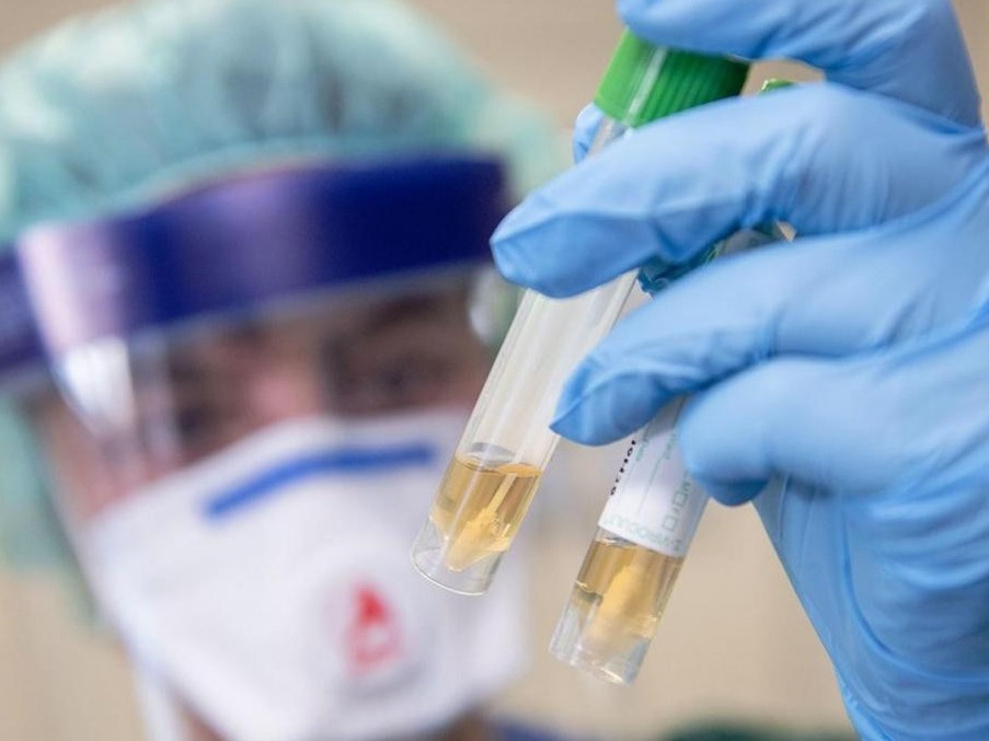 COVID-19: Вирустық геноцид жəне індеттің əлемдік демографияға əсері