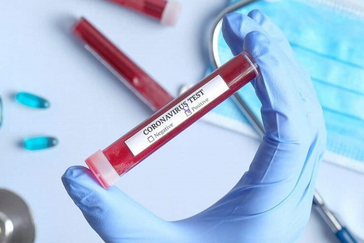 Қызылорда: Тағы үш адамнан инфекция анықталды