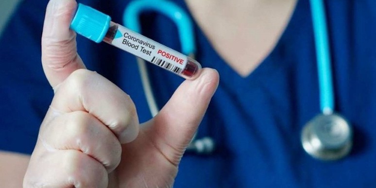 Телеарналар коронавирус туралы көп көрсетпеуі керек