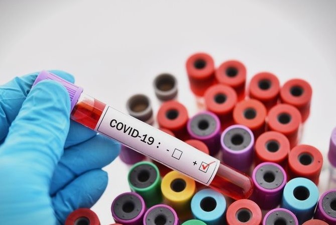 Қызылорда: Індет жұқтырғандар саны 25 адамға жетті