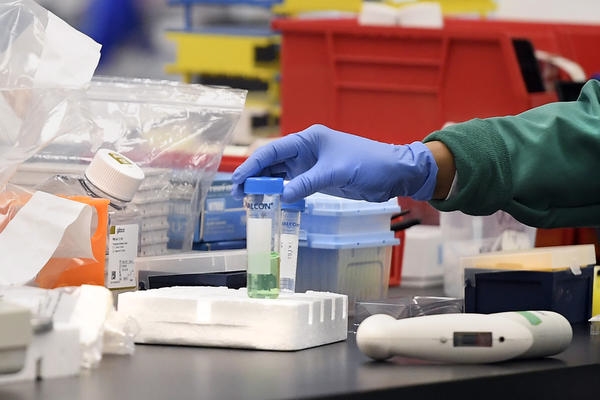 Түркістан облысында тағы 3 адамның індет жұқтырғаны анықталды