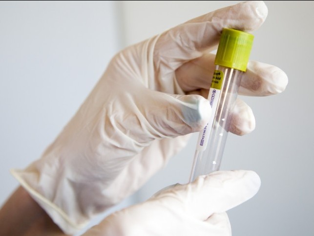 Қызылорда: Тест сынамалары жеткізілді