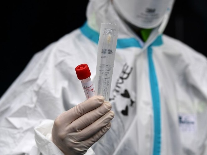 Түркістан облысында тағы 2 адамның індет жұқтырғаны анықталды