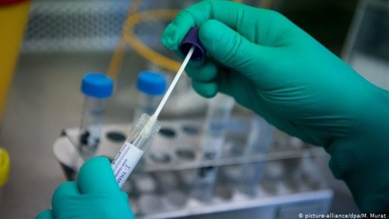 Ақмола облысында тағы 10 адам аты жаман аурудың қармағына ілікті