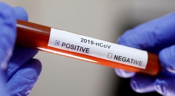 Түркістан: Ақтаудан келген арыстық азаматтың індет жұқтырғаны анықталды