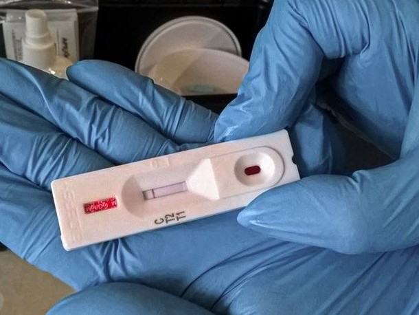 Алматыда коронавирус жұқтырған дәрігерлерге байланысты эпидемиологиялық тергеу басталды