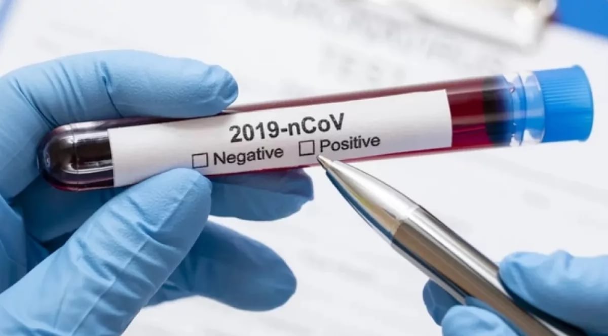 Ресейден келген жеті жұмысшы да індет жұқтырған