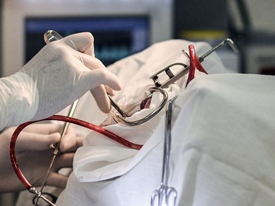 Көкшетауда адамның асқазанынан бір келі темір шықты