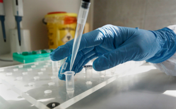 Қостанай облысында індетке шалдыққан 4 адам анықталды