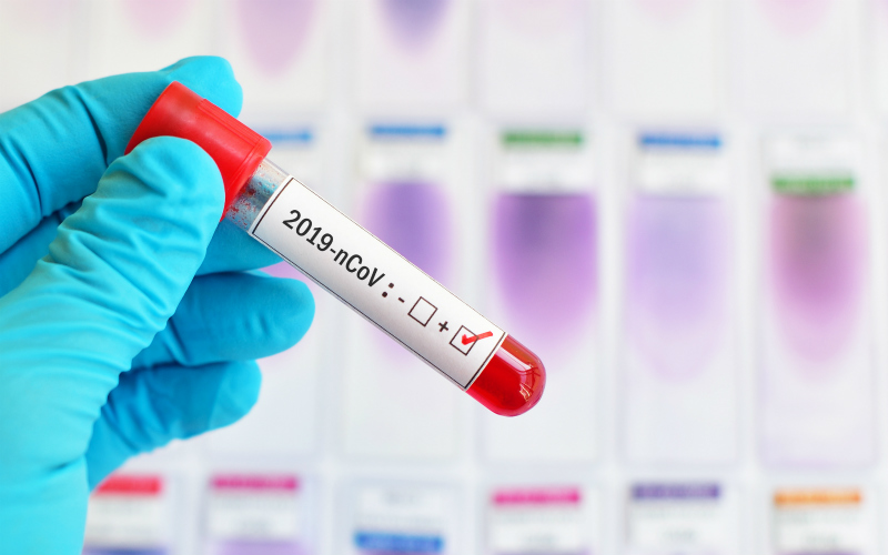 Алматыда 97 жастағы әжейге індет жұқты