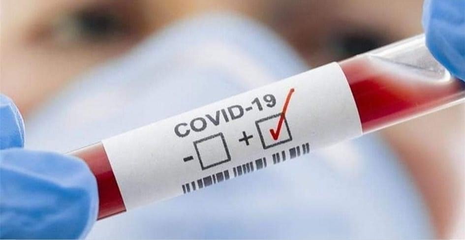 Алматыда індет жұқтырғандардың басым бөлігі 20-29 жас аралығындағылар