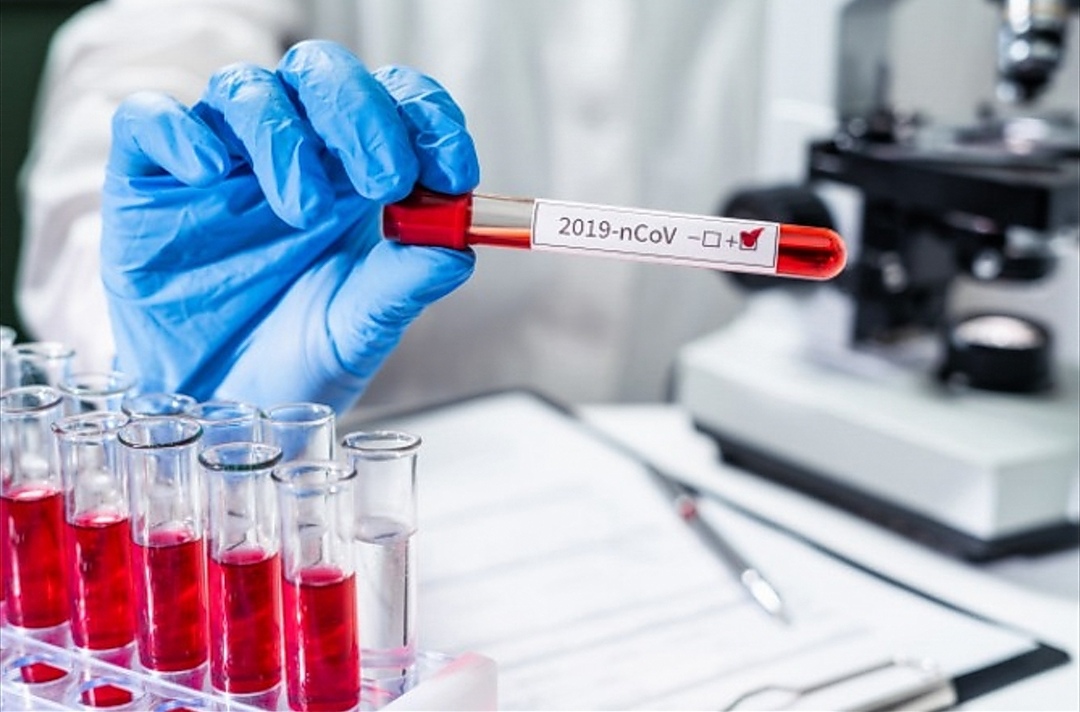 Қызылорда: Соңғы тәулікте 5 адам вирус жұқтырды