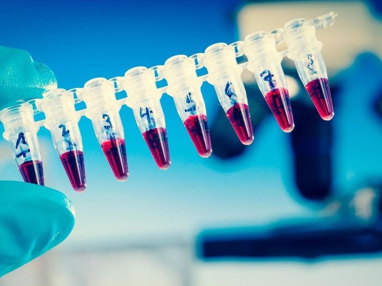 Теңіз кенішіндегі  жұмысшылардан 8000-нан астам анализ алынған