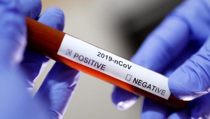 Батыс Қазақстанда өткен тәулікте 40 адам вирус жұқтырған