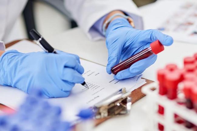 Кей өңірде вирус өрши түсті