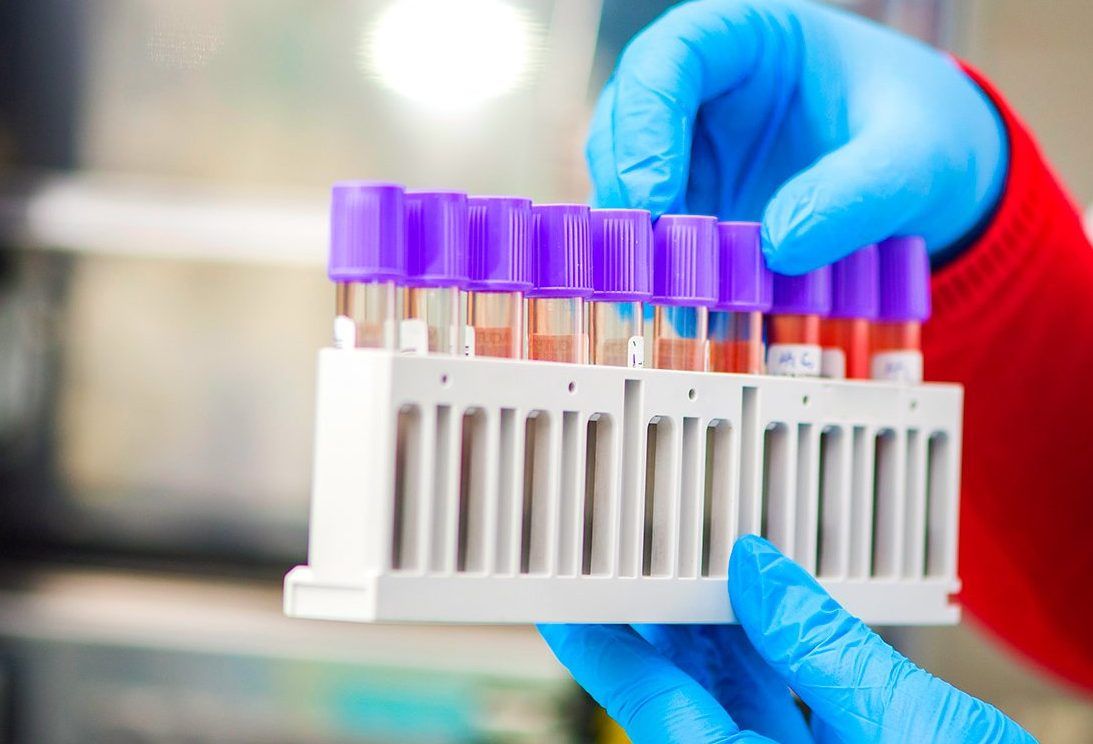 Атырауда NCOC қызметкері коронавирус жұқтырды