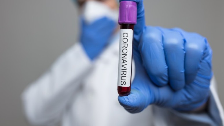 Жетісуда 2479 адам коронавирус жұқтырып, 1290 науқас дерттен айықты