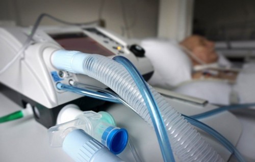 Қызылордаға өкпені жасанды желдету құрылғылары жеткізіледі