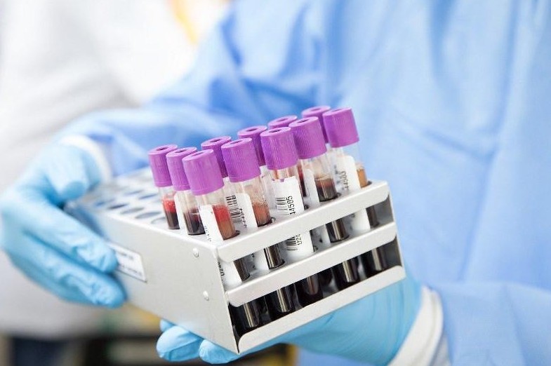 COVID-19: Тест қай кезде дұрыс көрсетпейді?