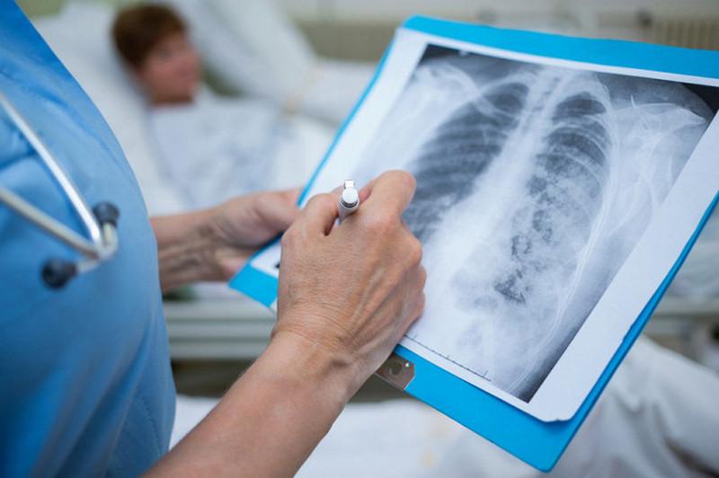 COVID-19: Қалыпты тірлік қалғалы қашан