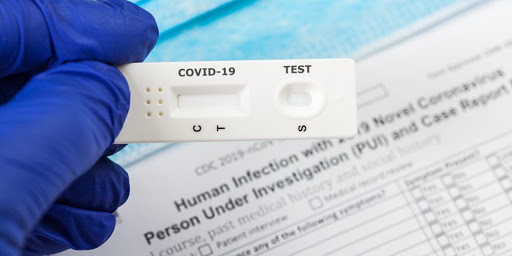 Бір тәулікте 944 түркістандық коронавирусқа тест тапсырды