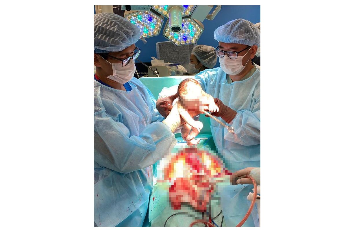 «Жендет» жасушаны жеңген ана Қазақстанда алғаш рет жатыр мойны обыры бар әйел босанды