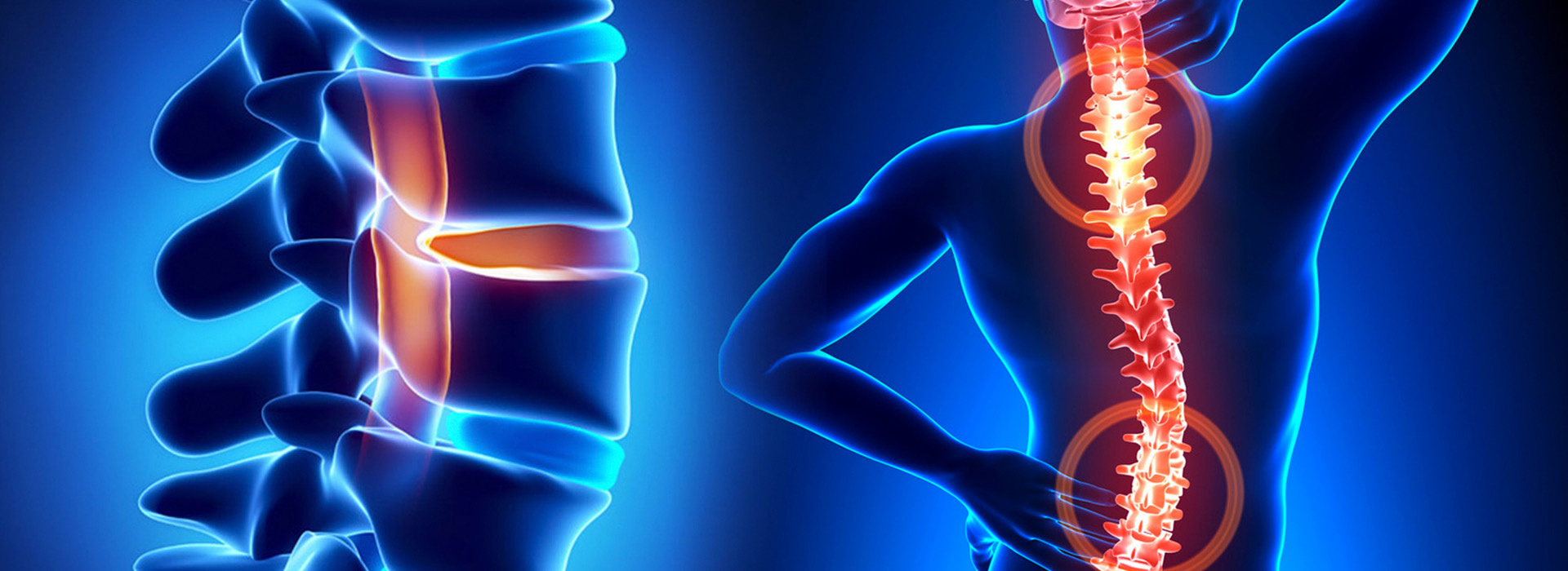 Ревматолог дәрігер Бехтерев ауруының пайда болу себептерін түсіндірді