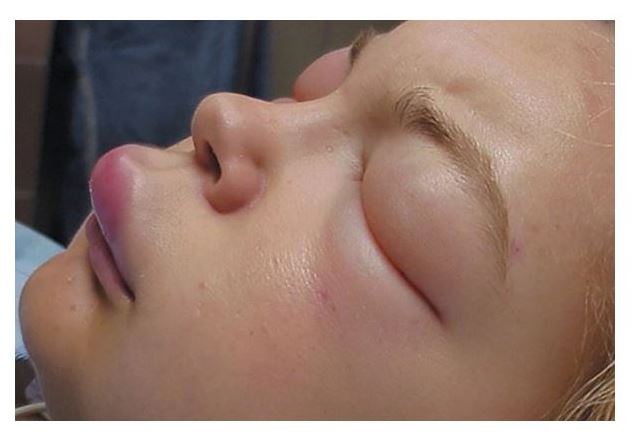 Сирек кеселге шалдыққан науқастардың дерті қалай анықталады?