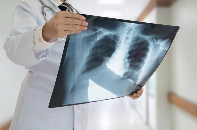 Өткен тәулікте пневмониямен 10 адам ауырып, 1 адам көз жұмды