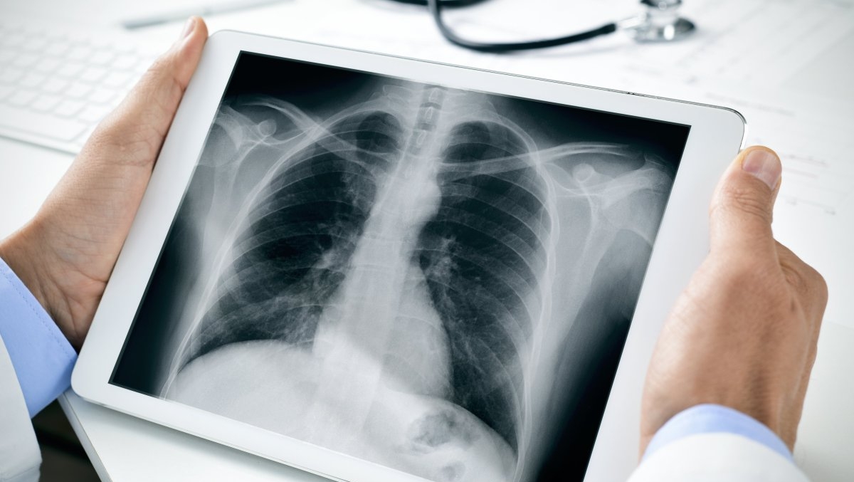 Коронавирустан кейін ағзаны қалай қалпына келтіруге болады?