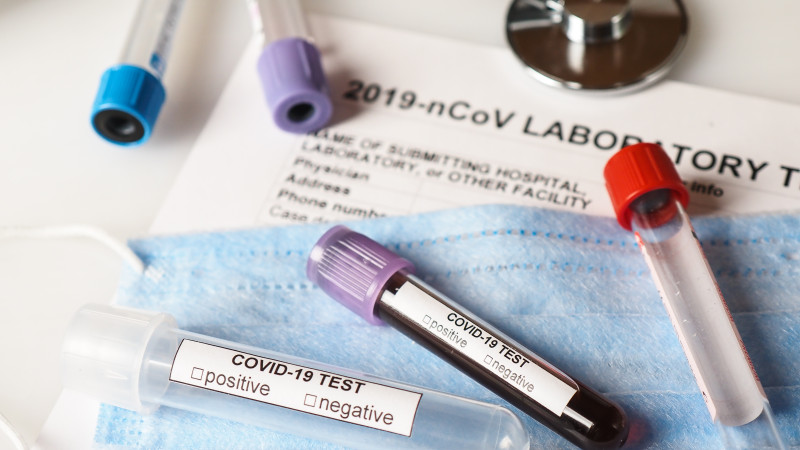 Атырауда тағы да 12 адам қауіпті індетке шалдықты