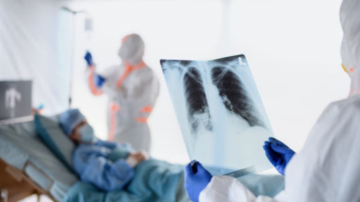 Маңғыстауда соңғы аптада 5 адам Cobid-19, 38 адам вирустық пневмония жұқтырған