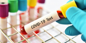 Атырауда коронавирус жұқтырғандар 124 адамға көбейді