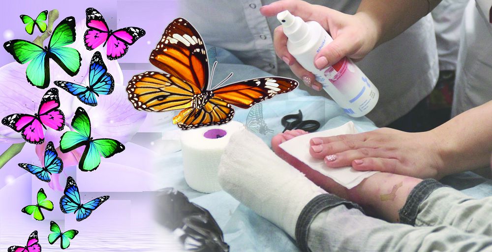 «Көбелек балалар». Сирек кездесетін кесел түрі көп