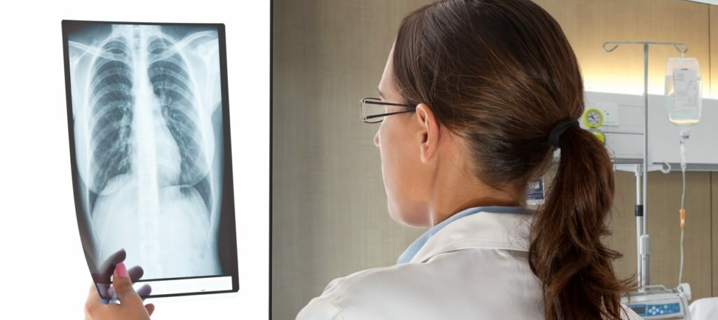 Туберкулездің таралуы төмендеген