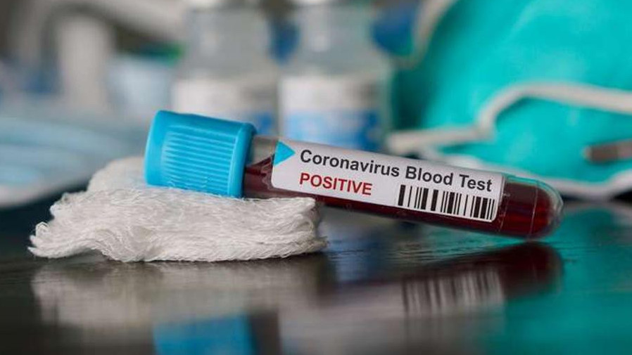 Атырауда коронавирусқа шалдыққандар саны 48 адамға көбейді