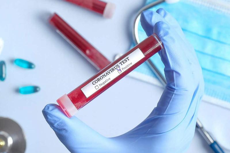 Маңғыстау облысында 12 оқушы және 4 мұғалім коронавирус жұқтырды