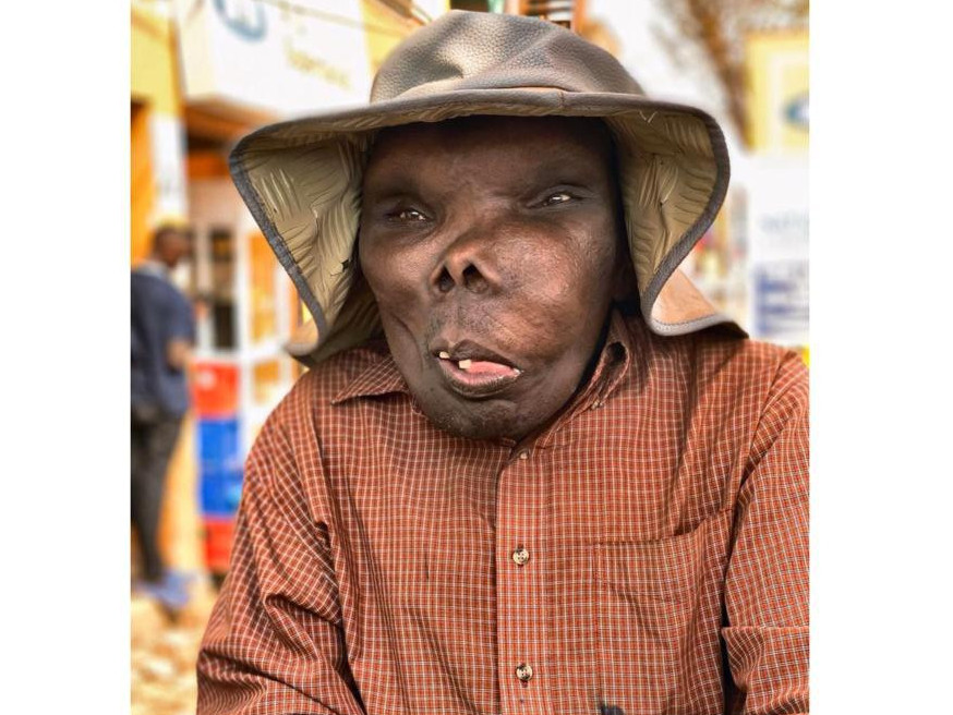 Әлемдегі «ең ұсқынсыз адам» кім екені белгілі болды