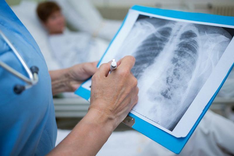 Пневмониядан 3 адам қайтыс болды