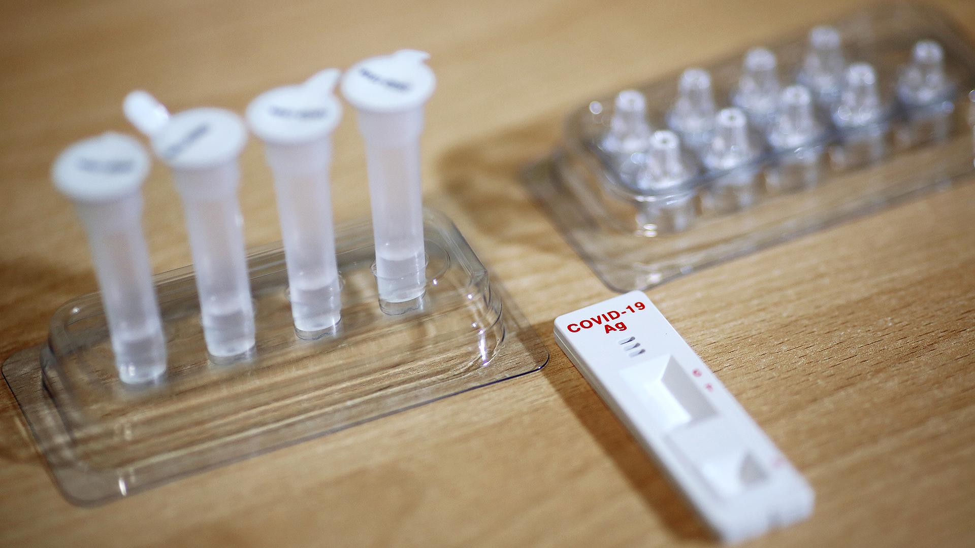 Коронавирусқа қарсы қандағы антиденелерді тексеру неге тиімсіз?