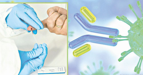 Коронавирусқа қарсы антиденені тексеру неге тиімсіз?