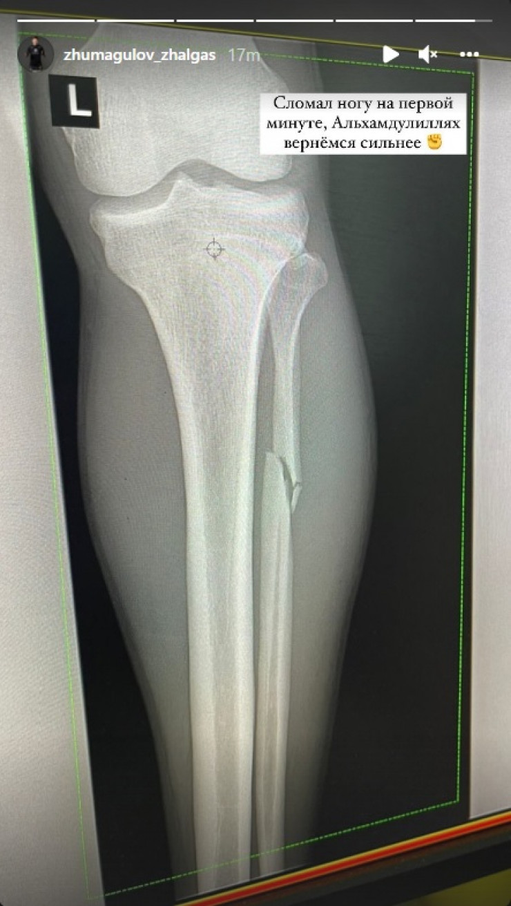 Жалғас Жұмағұлов соңғы жекпе-жекте аяғын сындырып алған